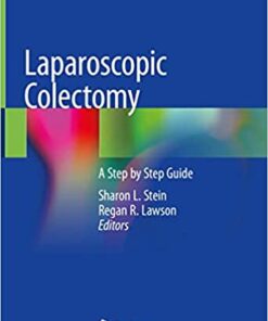 Laparoscopic Colectomy: A Step by Step Guide 1st ed. 2020 Edition PDF