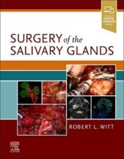 Surgery of the Salivary Glands 2020 Original PDF