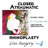 Closed Atraumatic Rhinoplasty Live Surgery DVD 4