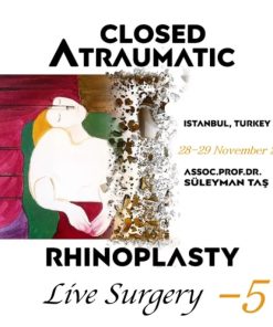 Closed Atraumatic Rhinoplasty Live Surgery DVD 5