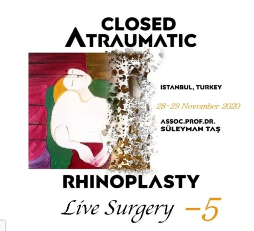 Closed Atraumatic Rhinoplasty Live Surgery DVD 5