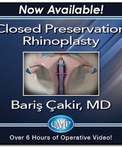 Closed Preservation Rhinoplasty 