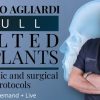 Full tilted implants Prosthetic and Surgical protocols