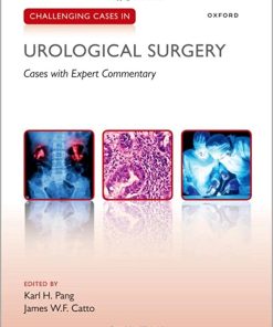 Challenging Cases in Urological Surgery