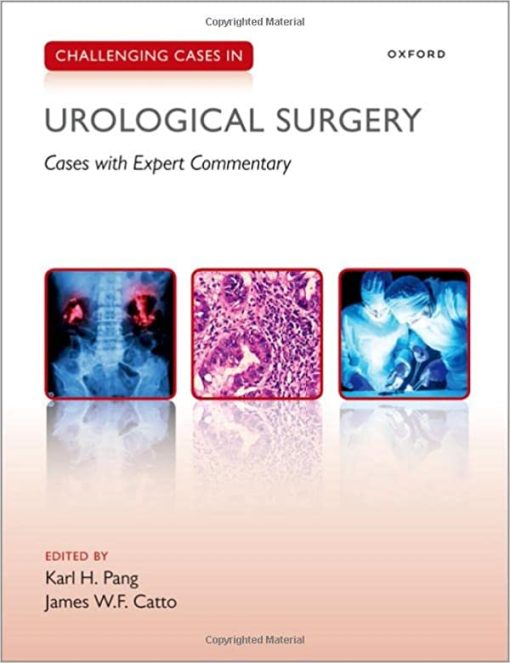 Challenging Cases in Urological Surgery