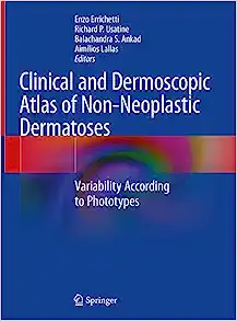 Clinical and Dermoscopic Atlas of Non-Neoplastic Dermatoses: Variability According to Phototypes