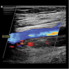 Clinical Approach to Vascular Ultrasound and RPVI Prep Course 2023