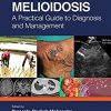 Clinical Melioidosis: A Practical Guide to Diagnosis and Management