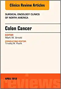 Colon Cancer, An Issue of Surgical Oncology Clinics of North America (Volume 27-2) (The Clinics: Surgery, Volume 27-2)