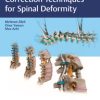 Correction Techniques for Spinal Deformity