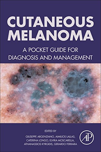 Cutaneous Melanoma: A Pocket Guide for Diagnosis and Management ()