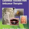 Cutaneous Reactions from Anti-Cancer Therapies ()