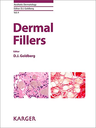 Dermal Fillers (Aesthetic Dermatology, Vol. 4)