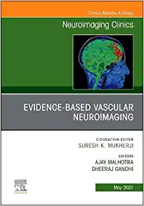Evidence-Based Vascular Neuroimaging, An Issue of Neuroimaging Clinics of North America (Volume 31-2) (The Clinics: Radiology, Volume 31-2)