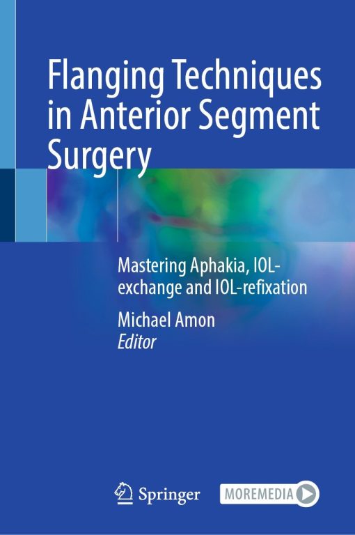 Flanging Techniques in Anterior Segment Surgery