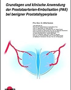 Grundlagen und klinische Anwendung der Prostataarterien-Embolisation (PAE) bei benigner Prostatahyperplasie (UNI-MED Science) (German Edition)