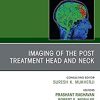 Imaging of the Post Treatment Head and Neck, An Issue of Neuroimaging Clinics of North America, E-Book (Clinics Collections)