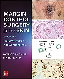 Margin Control Surgery of the Skin: Concepts, Histopathology, and Applications ()