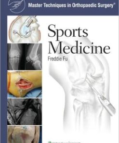 Master Techniques in Orthopaedic Surgery: Sports Medicine