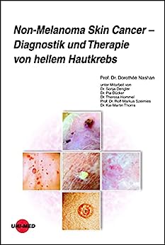 Non-Melanoma Skin Cancer – Diagnostik und Therapie von hellem Hautkrebs (UNI-MED Science) (German Edition)