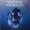 Operative Management of Vascular Anomalies ()