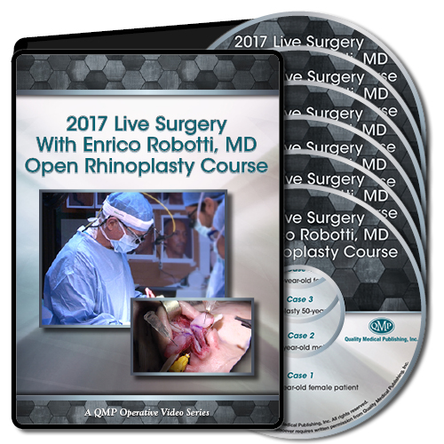 QMP 2017 Live Surgery With Enrico Robotti Open Rhinoplasty Course
