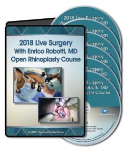 QMP 2018 Live Surgery With Enrico Robotti Open Rhinoplasty Course