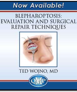 QMP Blepharoptosis: Evaluation and Surgical Repair Techniques 2022