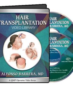 QMP Hair Transplantation 2017