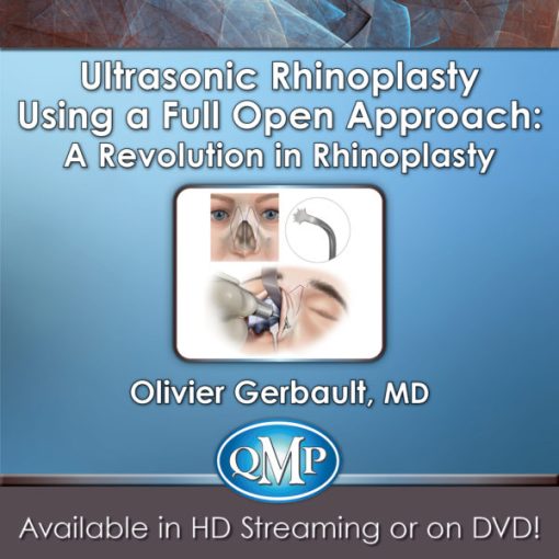 QMP Ultrasonic Rhinoplasty Using a Full Open Approach: A Revolution in Rhinoplasty 2018