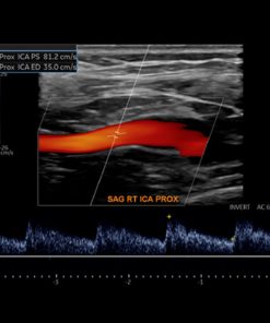 Society for Vascular Medicine Comprehensive Review of Vascular Ultrasound Interpretation and Registry Preparation 2023