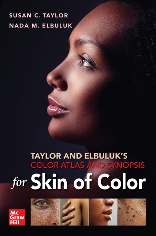 Taylor and Elbuluk’s Color Atlas and Synopsis for Skin of Color