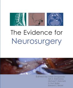 The Evidence for Neurosurgery ()