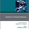 Treatment of Peritoneal Metastasis, An Issue of Surgical Oncology Clinics of North America (Volume 27-3) (The Clinics: Surgery, Volume 27-3)