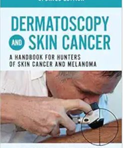 Dermatoscopy and Skin Cancer