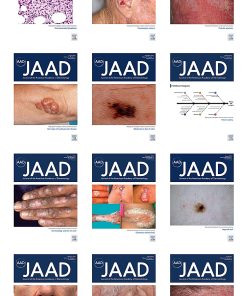 Journal of the American Academy of Dermatology